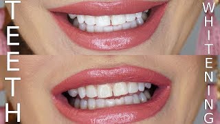 DIY Teeth Whitening Using Charcoal amp Baking Soda [upl. by Goodrow]