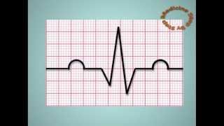 Understanding ECGs  EKG [upl. by Limoli]