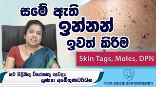 Warts Skin Tags Moles and DPN සමේ ඇති ඉන්නන් ඉවත් කිරීම  Dr Punya Abeygunawardana skincare [upl. by Yeliab442]