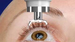 Unique DIATON Tonometry Through Eyelid  with Diaton Tonometer  Introduction  Description Part1 [upl. by Corotto]