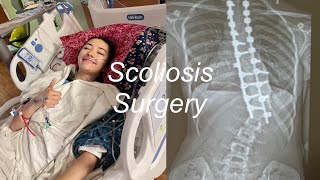 Scoliosis Surgery Vlog recovery amp awareness [upl. by Stanhope]