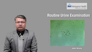 Diagnosis amp Treatment of Foamy Urine  Dr Vikas Jain [upl. by Longmire]