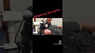 Ankylosing Spondylitis Treatment SoCalChiropractic ​ [upl. by Eadrahs784]