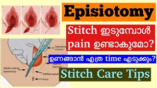 Episiotomy Malayalam│How to take care of Stitches After Normal Delivery│When to consult a Doctor [upl. by Acie]