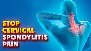 5 Cervical Spondylitis Exercises for Quick Relief [upl. by Ayanal904]