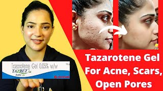 How to remove scars  Scar creams  Tazaroten Gel  Tazret Gel 005 Review  Tazaroten Cream 01 [upl. by Mcnully]