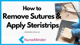 How to Remove Sutures and Apply Steristrips Nursing Skills [upl. by Hahseram]