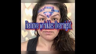 Get Rid Of Forehead Wrinkles Overnight Naturally [upl. by Ahtilat]