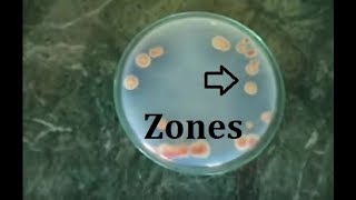 How to isolate phosphate solubilizing bacteria [upl. by Nollie]