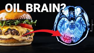 The 212 Billion Dollar Food ingredient poisoning your Brain [upl. by Lacey]