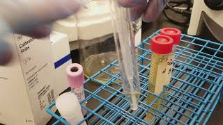 Urinalysis Preparing the 3 patient urine specimens for microscopic analysis [upl. by Jane]