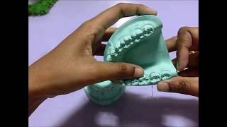 Ernst Ligature procedure for intermaxillary wiring on dental model [upl. by Loyce852]