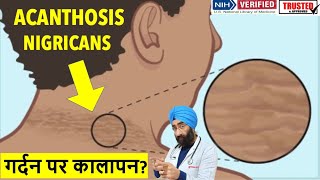 गर्दन पे कालापन  Dark skin around Neck  Acanthosis Nigricans  DrEducation [upl. by Allesor]