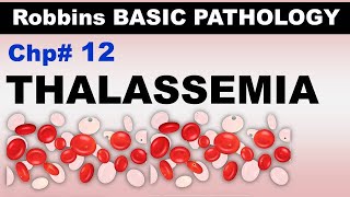 Ch12  Thalassemias  αThalassemia  βThalassemia  Blood Pathology  Dr Asif Lectures [upl. by Ganny514]