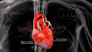 What is atrial fibrillation [upl. by Denn197]