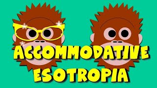 Accommodative esotropia  Gama Eye Care EN [upl. by Clarabelle]