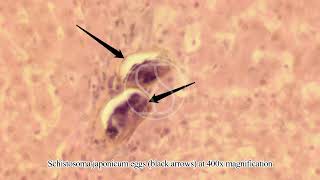 Schistosoma japonicum Egg in Tissue with Haematoxylin and Eosin HampE Stain [upl. by Hepza6]