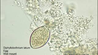 Diphyllobothrium latum egg [upl. by Zaid]