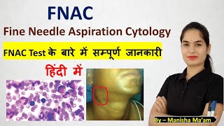 Fine Needle Aspiration Cytology  FNAC Test in hindi  FNAC test kya hota hai  FNAC test procedure [upl. by Milzie]