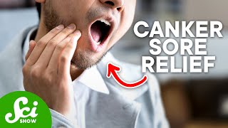 How to Get Rid of Canker Sores According to Science [upl. by Valerlan]