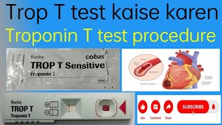 Trop T test kaise karen  Troponin T test procedure  Trop T blood test kaise kare [upl. by Kcinom421]