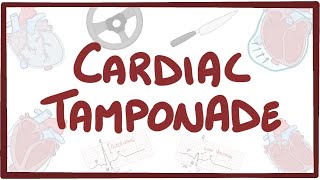 Cardiac tamponade  causes symptoms diagnosis treatment pathology [upl. by Friend]