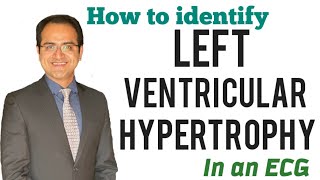 Left Ventricular Hypertrophy ECG Changes Skolow Lyon Criteria Explained ECG Lectures USMLE NEETPG [upl. by Oigolue]