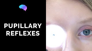 Pupillary Reflexes  OSCE Guide Clip  UKMLA  CPSA [upl. by Charlton]