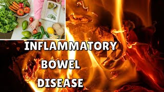 inflammatory bowel disease ulcerative colitis crohns disease [upl. by Yleak799]