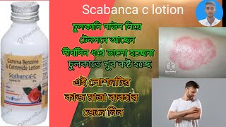 Gamma benzene cetrimideScabanca lotion চুলকানির ক্ষেত্রে ব্যবহার করা হয় scabanca lotion [upl. by Terrell]