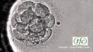 Human Embryo Growing from Fertilization to Day 6 Blastocyst [upl. by Most]