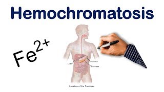 Hemochromatosis  USMLE COMLEX NCLEX [upl. by Damian]