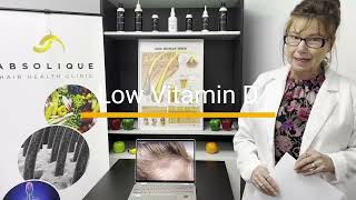 Low Ferritin Hair Loss Female [upl. by Thamora]