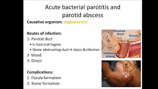 salivary gland infections [upl. by Adnak]