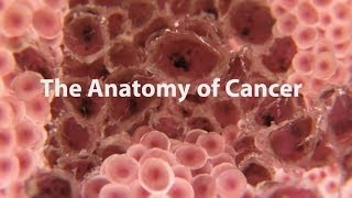 What Is Cancer What Causes Cancer amp How Is It Treated [upl. by Jennifer420]