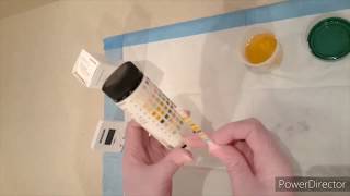 Urinalysis Random Sample [upl. by Ahsitul793]