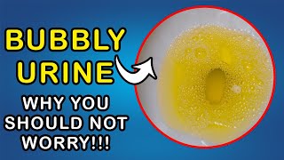 BUBBLES IN URINE Why you dont need to worry [upl. by Tadd301]