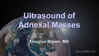 quotUltrasound of Adnexal Massesquot Ultrasound SonoWorld Lecture [upl. by Nahgeam529]