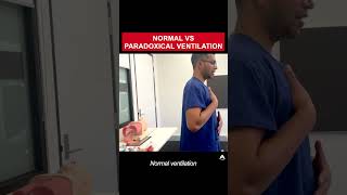 Normal vs Paradoxical Ventilation  anesthesia bagmaskventilation airway [upl. by Osicnarf540]