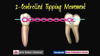 Types of Orthodontic Tooth movement [upl. by Michiko414]