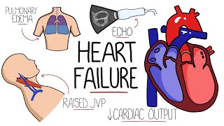 Heart Failure Explained  HFrEF vs HFpEF Systolic vs Diastolic Heart Failure [upl. by Skinner366]