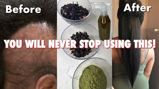 do not USE this hair treatment if you’re not ready for Extreme HAIR growth [upl. by Danita]