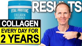 Vital Proteins Collagen Peptides  Results After 2 Years [upl. by Llenrag849]