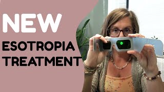 New Treatment For Esotropia [upl. by Ailyn]