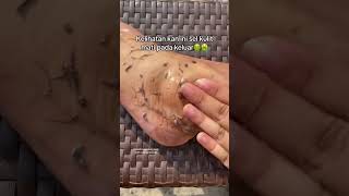 Deep Cleansing Remove Dust and Dead Skin ameenbeautytips GlowAndCleanByAmeen [upl. by Blanc]