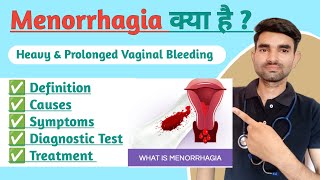 Menorrhagia in Hindi  Causes Symptoms And Treatment of Menorrhagia [upl. by Teilo]