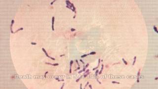 Corynebacterium diphtheriae amp Diphtheria [upl. by Eiznekam]