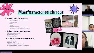 NOCARDIA MICROBIOLOGIA CES [upl. by Kingdon]