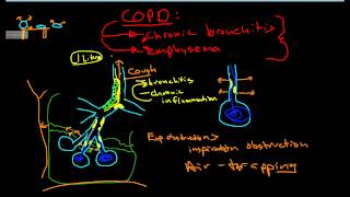 Pathophysiology of COPD [upl. by Adim]