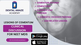 Clinical Discussions Lesions of cementum amp related lesions For NEET MDS [upl. by Buck]